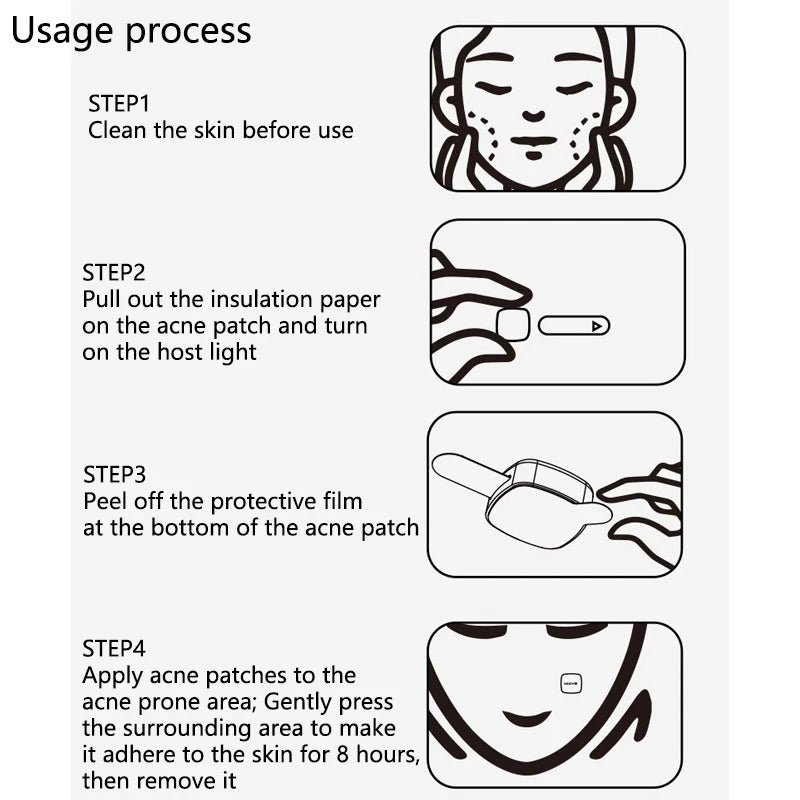 Electronic Beauty Device For Cleansing And Fading Acne Marks